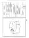 Fig. 02 - COMPUTER-IMPLEMENTED METHOD FOR VIRTUALLY MODIFYING A DIGITAL MODEL OF A DENTAL RESTORATION AND A COMPUTER-READABLE MEDIUM