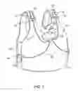 Fig. 02 - Multiple buckle release system