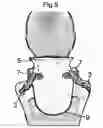 Fig. 06 - Sleepy heads neck pillow