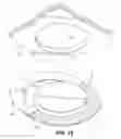 Fig. 10 - Drywall repair kit