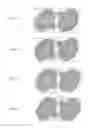 Fig. 06 - Method of packaging and dispensing nasal devices