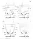 Fig. 04 - PACKAGING CONTAINERS HAVING CONFORMATION INDUCTION MEMBERS AND METHODS OF MAKING AND USING SAME