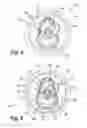 Fig. 06 - Container end closure with optional secondary vent opening