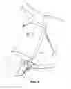Fig. 05 - HORSE BIT