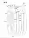Fig. 08 - Filter arrangements; housings; assemblies; and, methods
