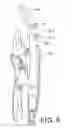 Fig. 05 - Locking pliers with retractable pivotal movable jaw