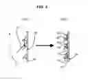 Fig. 04 - Divided annular rib type plasma processing apparatus