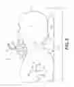 Fig. 03 - CRICOID MANIPULATING APPARATUS FOR ANESTHESIA ASSISTANCE AND TRACHEAL INTUBATION