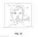 Fig. 09 - CRICOID MANIPULATING APPARATUS FOR ANESTHESIA ASSISTANCE AND TRACHEAL INTUBATION