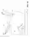 Fig. 12 - CRICOID MANIPULATING APPARATUS FOR ANESTHESIA ASSISTANCE AND TRACHEAL INTUBATION