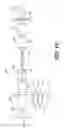 Fig. 15 - CRICOID MANIPULATING APPARATUS FOR ANESTHESIA ASSISTANCE AND TRACHEAL INTUBATION