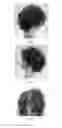 Fig. 02 - Method For Achieving and Semi-Permanently Retaining a Hairstyle