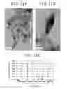 Fig. 11 - DYE-SENSITIZED SOLAR CELL AND PROCESS FOR PRODUCTION THEREOF