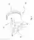 Fig. 05 - Die casting cooled pistons