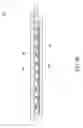 Fig. 05 - Capillary structure of heat plate