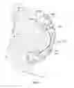 Fig. 12 - Drill Bits With Rolling Cone Reamer Sections