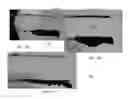 Fig. 16 - METHOD AND APPARATUS FOR REMOVAL OF PARTICLES FROM LUBRICATING OIL