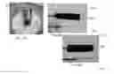 Fig. 17 - METHOD AND APPARATUS FOR REMOVAL OF PARTICLES FROM LUBRICATING OIL