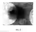 Fig. 06 - Immunoassay method and device with magnetically susceptible bead capture