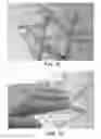 Fig. 03 - Transporting and Treating Water