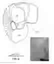 Fig. 09 - Transporting and Treating Water