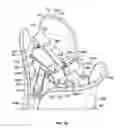 Fig. 31 - Shroud and Dispensing System for a Handheld Container
