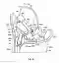 Fig. 31 - Shroud and Dispensing System for a Handheld Container
