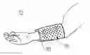 Fig. 01 - ARM GRIPPER