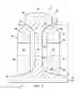 Fig. 03 - Leveling rail joints with oblique support