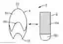 Fig. 01 - Adhesively mounted article support assembly with exposed pull tab