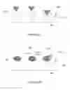 Fig. 05 - Backside stimulated sensor with background current manipulation