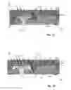 Fig. 11 - Electronic device including MEMS devices and holed substrates, in particular of the LGA or BGA type