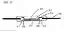 Fig. 38 - Die pad package with a concave portion in the sealing resin