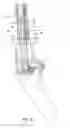 Fig. 10 - Foldable walker apparatus