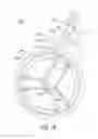Fig. 15 - Foldable walker apparatus