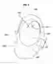 Fig. 07 - Pre-crash side air bag device