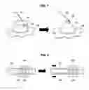 Fig. 08 - Pre-crash side air bag device