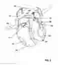 Fig. 03 - Dough ball lifter