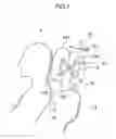 Fig. 02 - Headrest device, method of adjusting headrest position, and vehicle seat