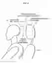 Fig. 09 - Headrest device, method of adjusting headrest position, and vehicle seat
