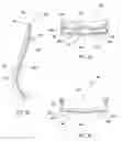 Fig. 19 - ARMREST FOR AN AIRCRAFT SEAT