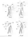 Fig. 34 - ARMREST FOR AN AIRCRAFT SEAT
