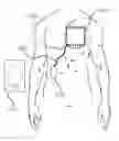Fig. 01 - Wireless energy transfer for implantable devices