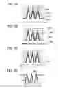 Fig. 08 - Field emission display with antireflective layer