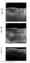 Fig. 08 - Spatial intensity correction for RF shading non-uniformities in MRI