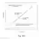 Fig. 13 - Spatial intensity correction for RF shading non-uniformities in MRI