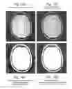 Fig. 14 - Spatial intensity correction for RF shading non-uniformities in MRI