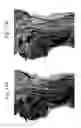 Fig. 15 - Spatial intensity correction for RF shading non-uniformities in MRI