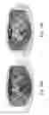 Fig. 20 - Spatial intensity correction for RF shading non-uniformities in MRI