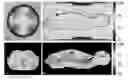 Fig. 01 - Method and coils for human whole-body imaging at 7 T